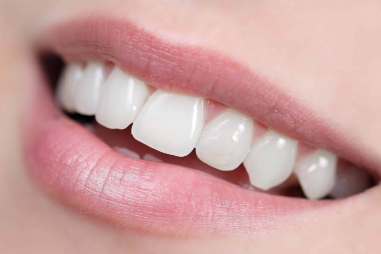 Teeth Whitening Aberdeen